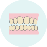 治療前の歯の色をチェック
