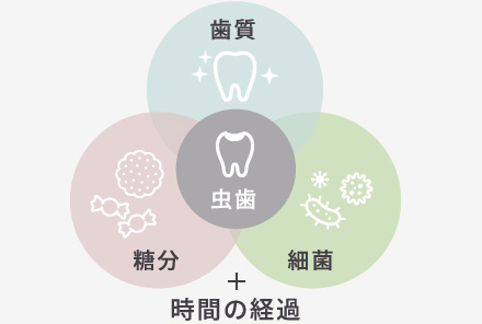 歯質・糖分・細菌・虫歯＋時間の経過