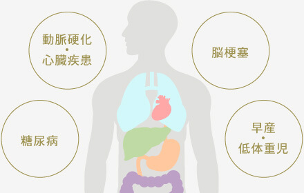 動脈硬化・心臓疾患、脳梗塞、糖尿病、早産・低体重児